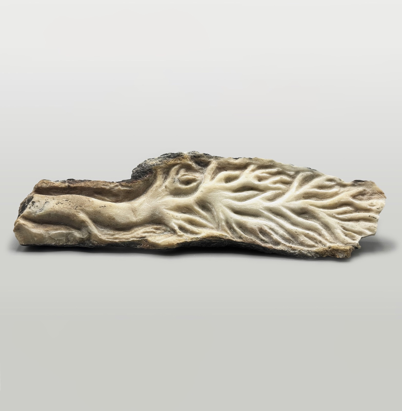 Aorta — another view